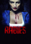 Rabies